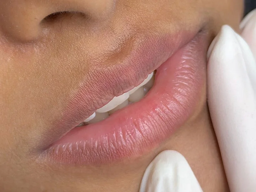 Lips before lip tint